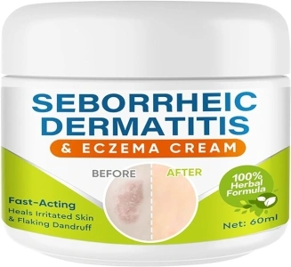 Sêborrheic Dêrmatitis Cream for Fôlliculitis Treatment, Premium Psôriasis Cream for Adults, Eczêma Cream for Dândruff Treatment and Effective Rêlief Îtchy Skin, 2.1 Oz